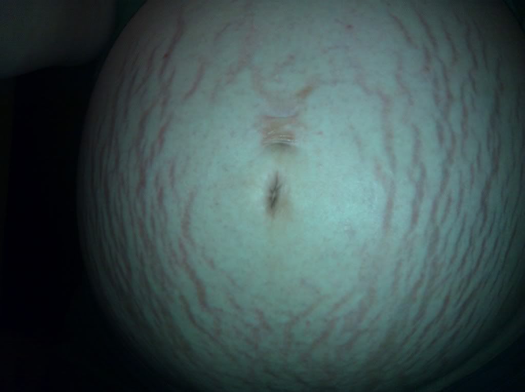 UGLIEST BELLY CONTEST BabyCenter
