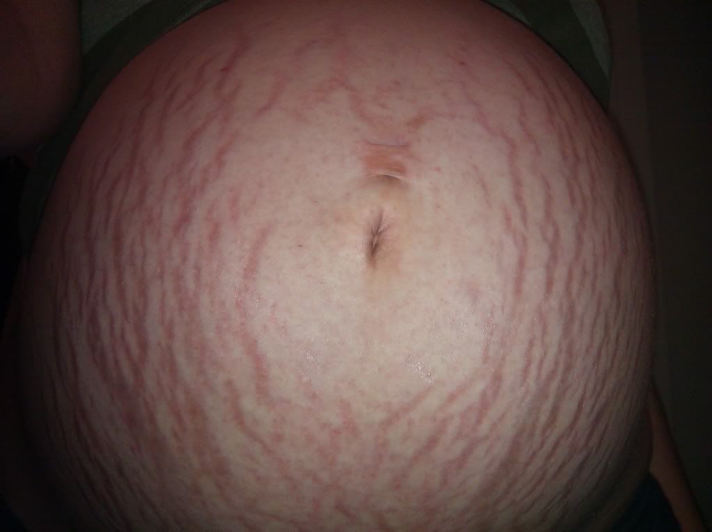 UGLIEST BELLY CONTEST - BabyCenter